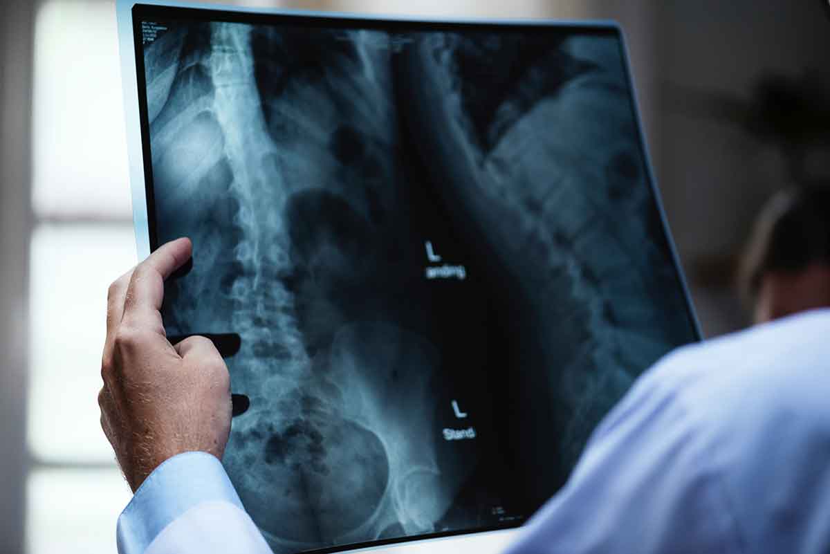 Esperando los resultados de las pruebas del cáncer de mama